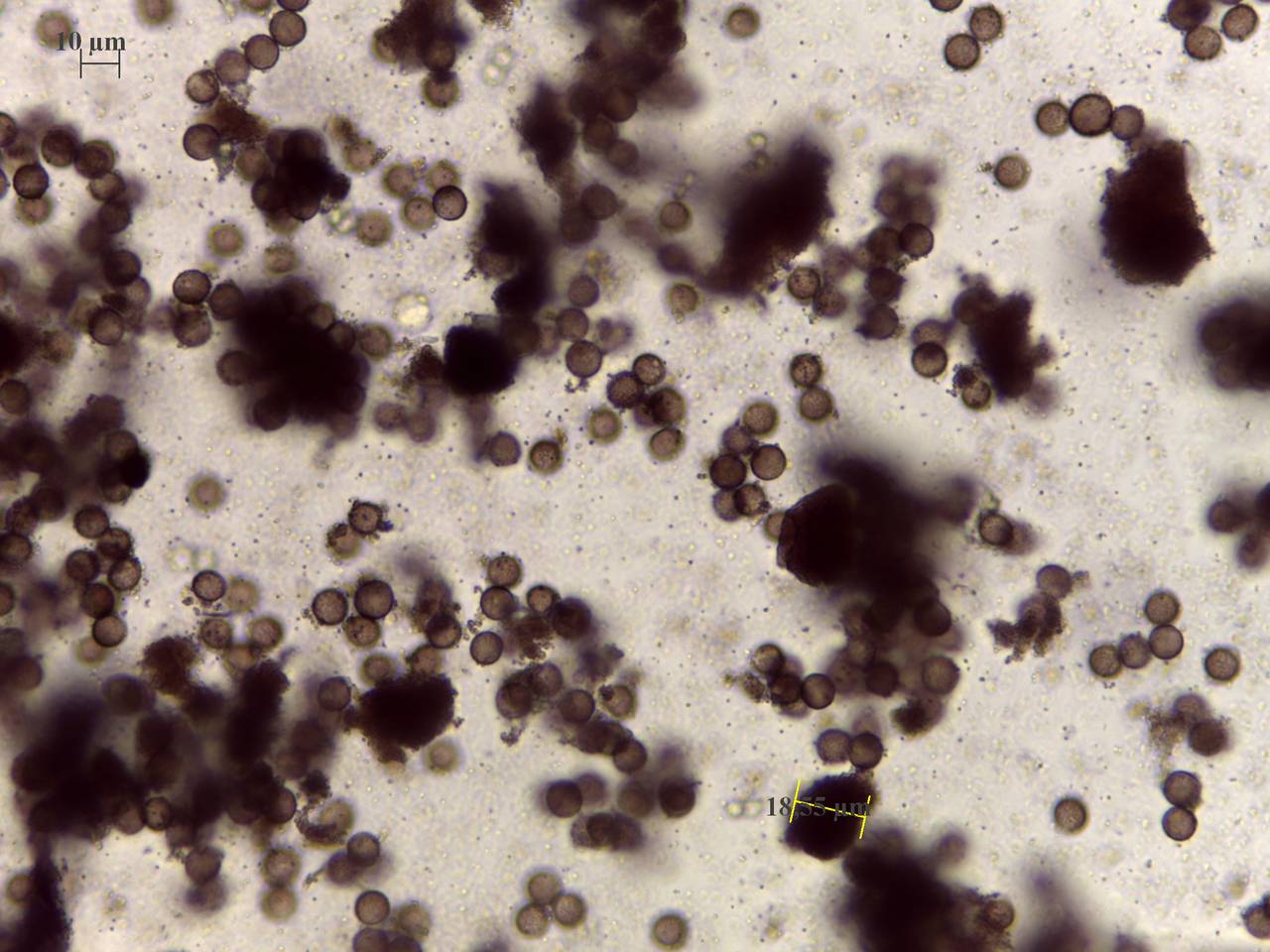 Physarum pulcherrimum - споры × 1000, Нелидовский, Tver Oblast (Russia)