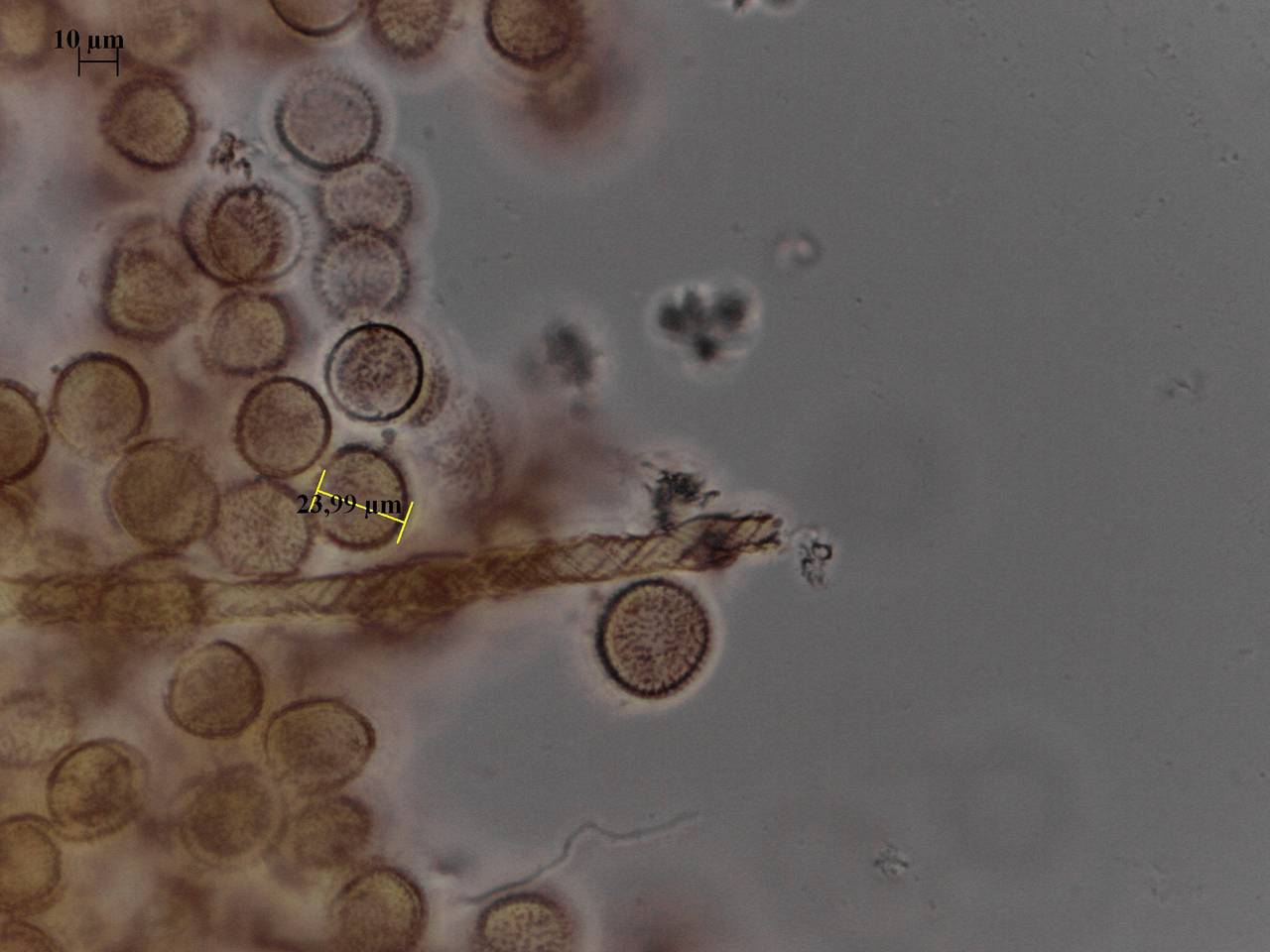 Trichia lutescens - внешний вид спороношений, Нелидовский, Tver Oblast (Russia)