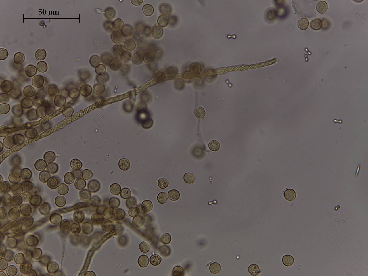 Trichia lutescens - внешний вид спороношений, Нелидовский, Tver Oblast (Russia)