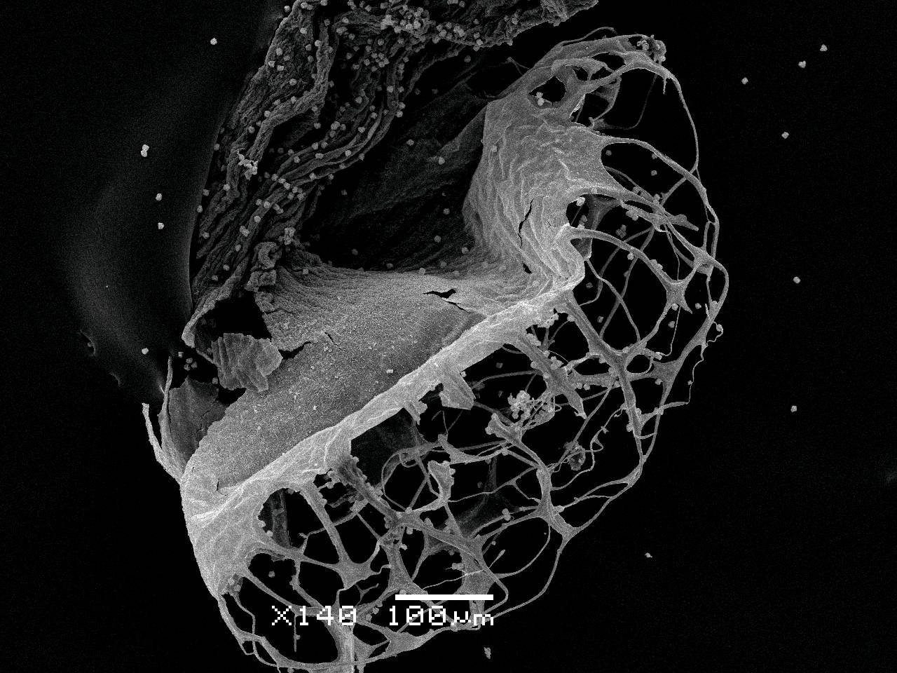 Cribraria rufa - Внешний вид сеточки перидия, отходящей от чашечки спорангия, Нелидовский, Tver Oblast (Russia)