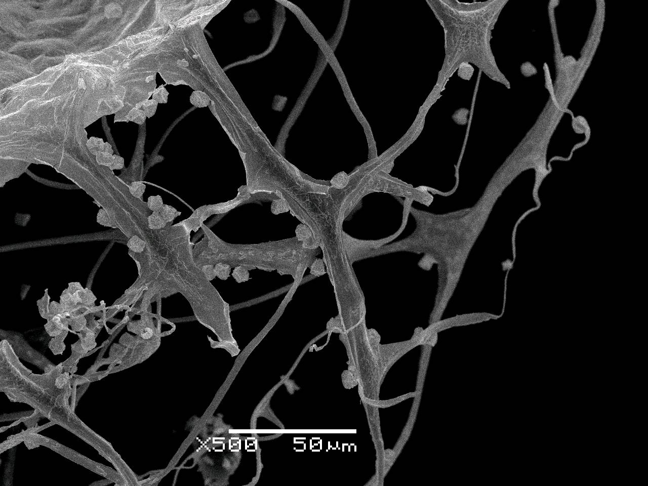 Cribraria rufa - Внешний вид сеточки перидия, отходящей от чашечки спорангия, Нелидовский, Tver Oblast (Russia)