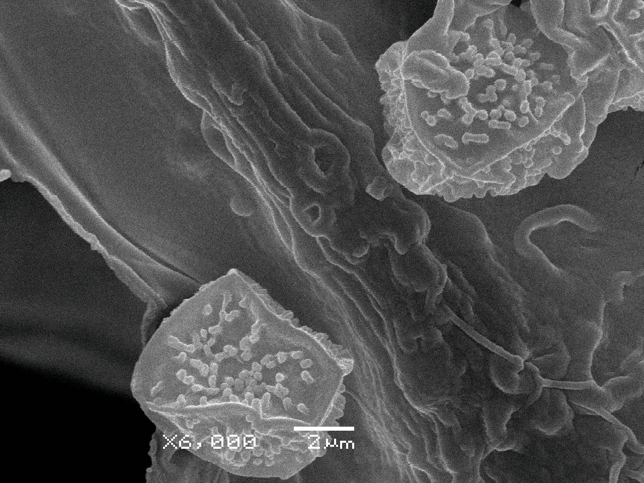 Cribraria rufa - Внешний вид сеточки перидия, отходящей от чашечки спорангия, Нелидовский, Tver Oblast (Russia)