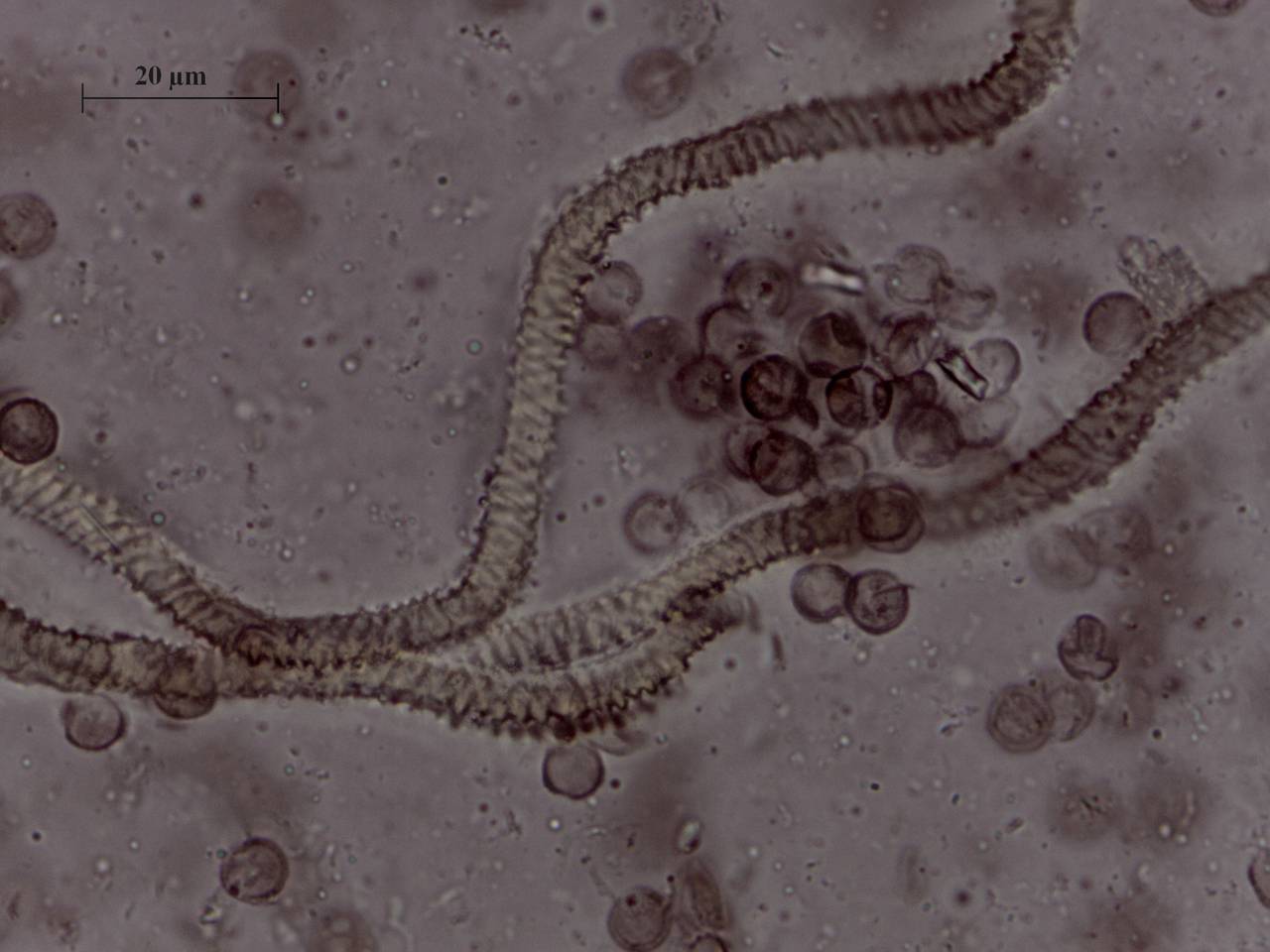 Arcyria stipata - капиллиций и споры × 1000, Нелидовский, Tver Oblast (Russia)