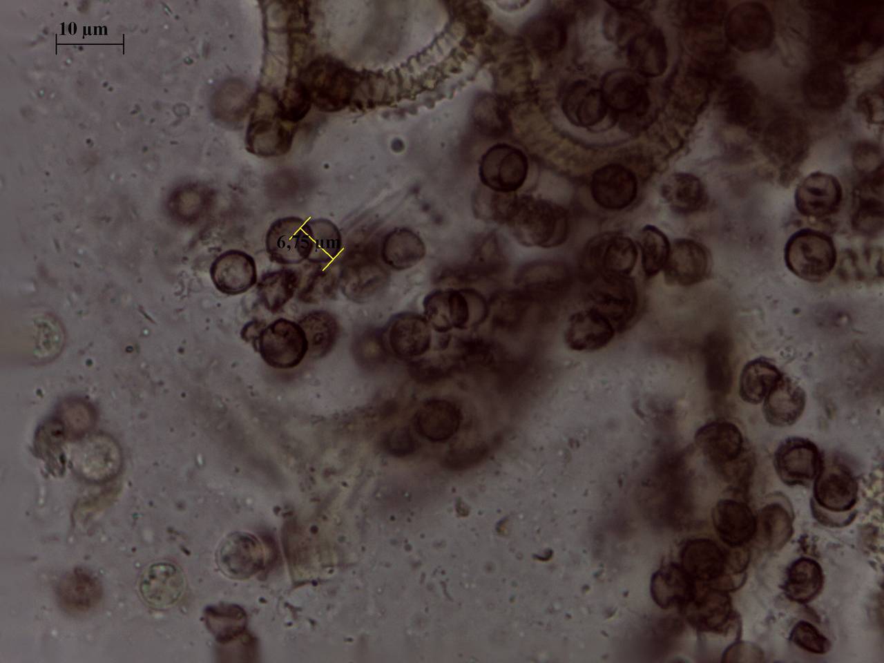 Arcyria stipata - капиллиций и споры × 1000, Нелидовский, Tver Oblast (Russia)