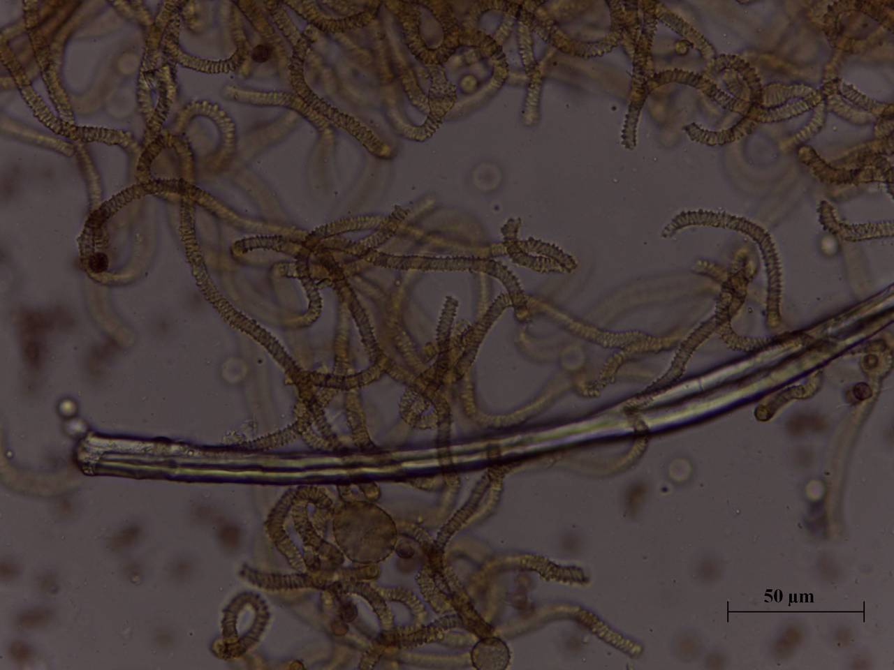 Arcyria stipata - капиллиций и споры × 1000, Нелидовский, Tver Oblast (Russia)