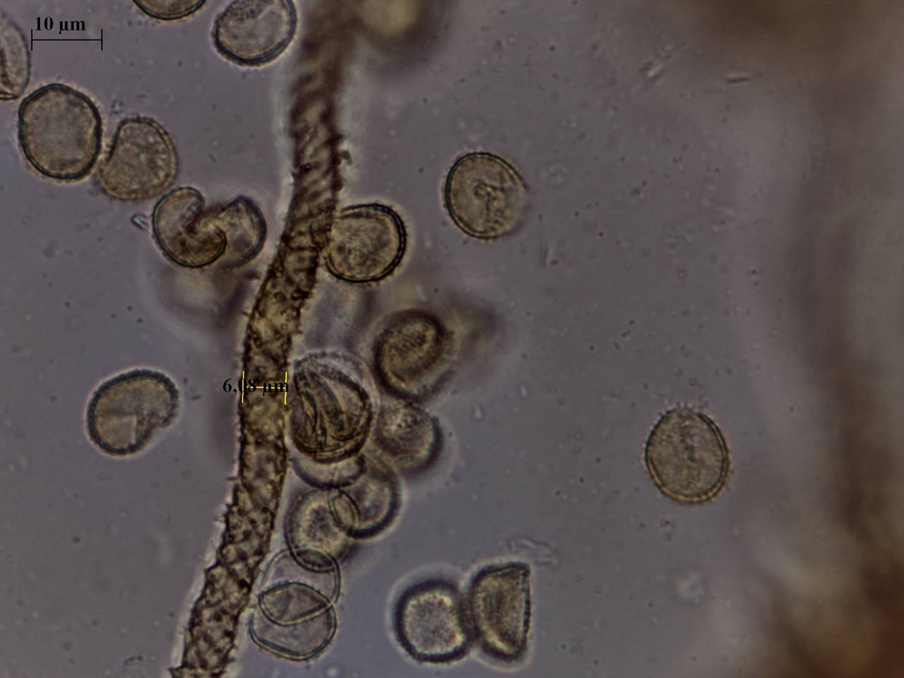 Trichia erecta - внешний вид спороношений, Нелидовский, Tver Oblast (Russia)