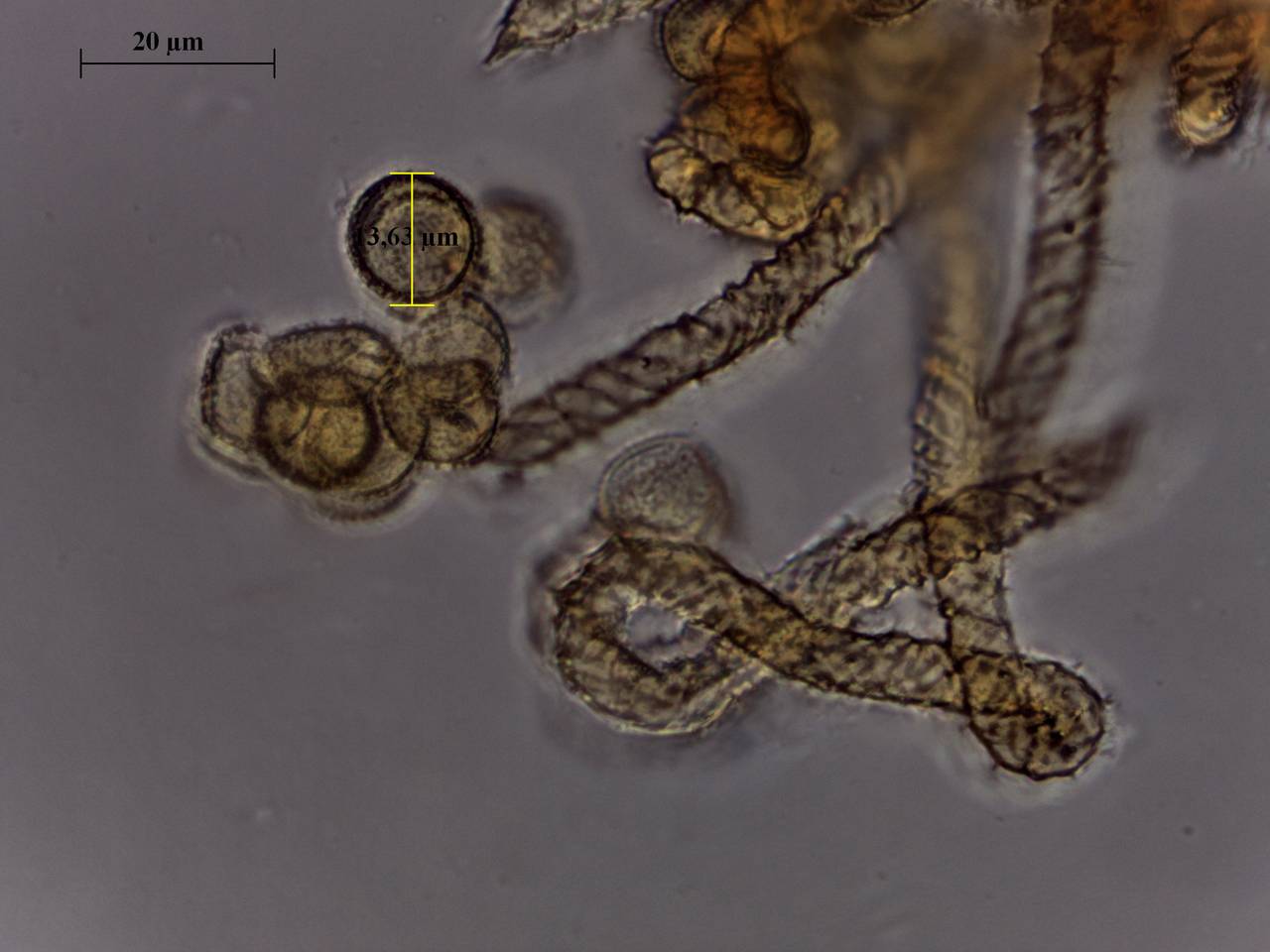 Trichia erecta - внешний вид спороношений, Нелидовский, Tver Oblast (Russia)