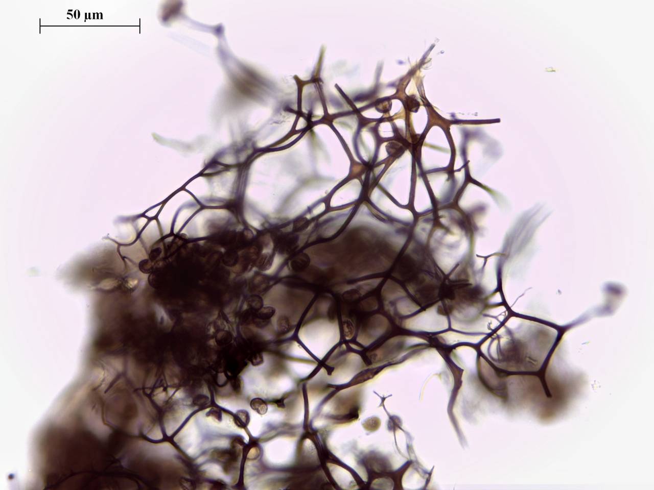 Diachea leucopodia - фрагмент сети капиллиция × 400, Нелидовский, Tver Oblast (Russia)