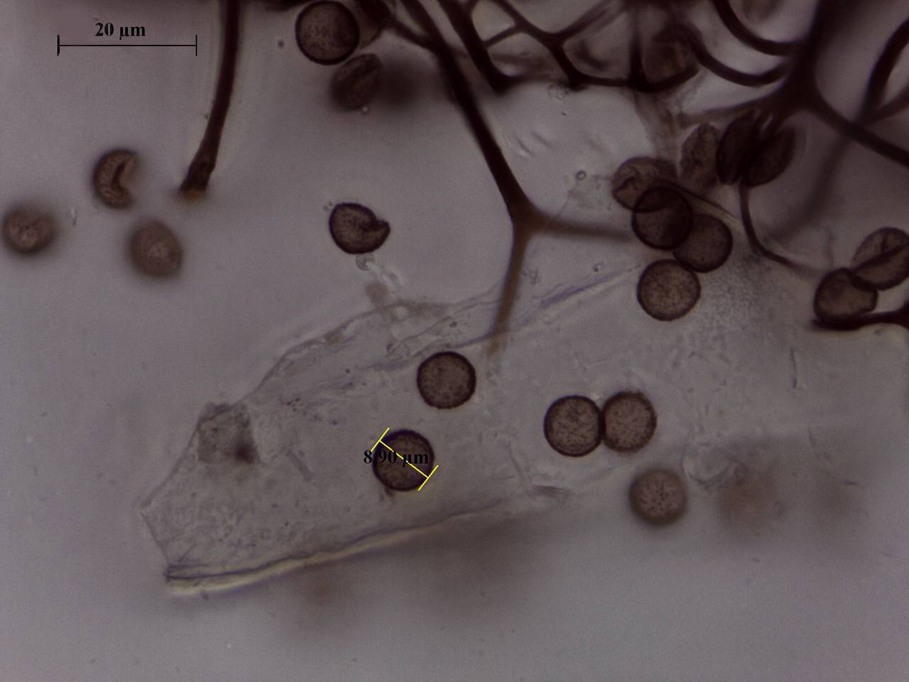 Diachea leucopodia - фрагмент сети капиллиция × 400, Нелидовский, Tver Oblast (Russia)