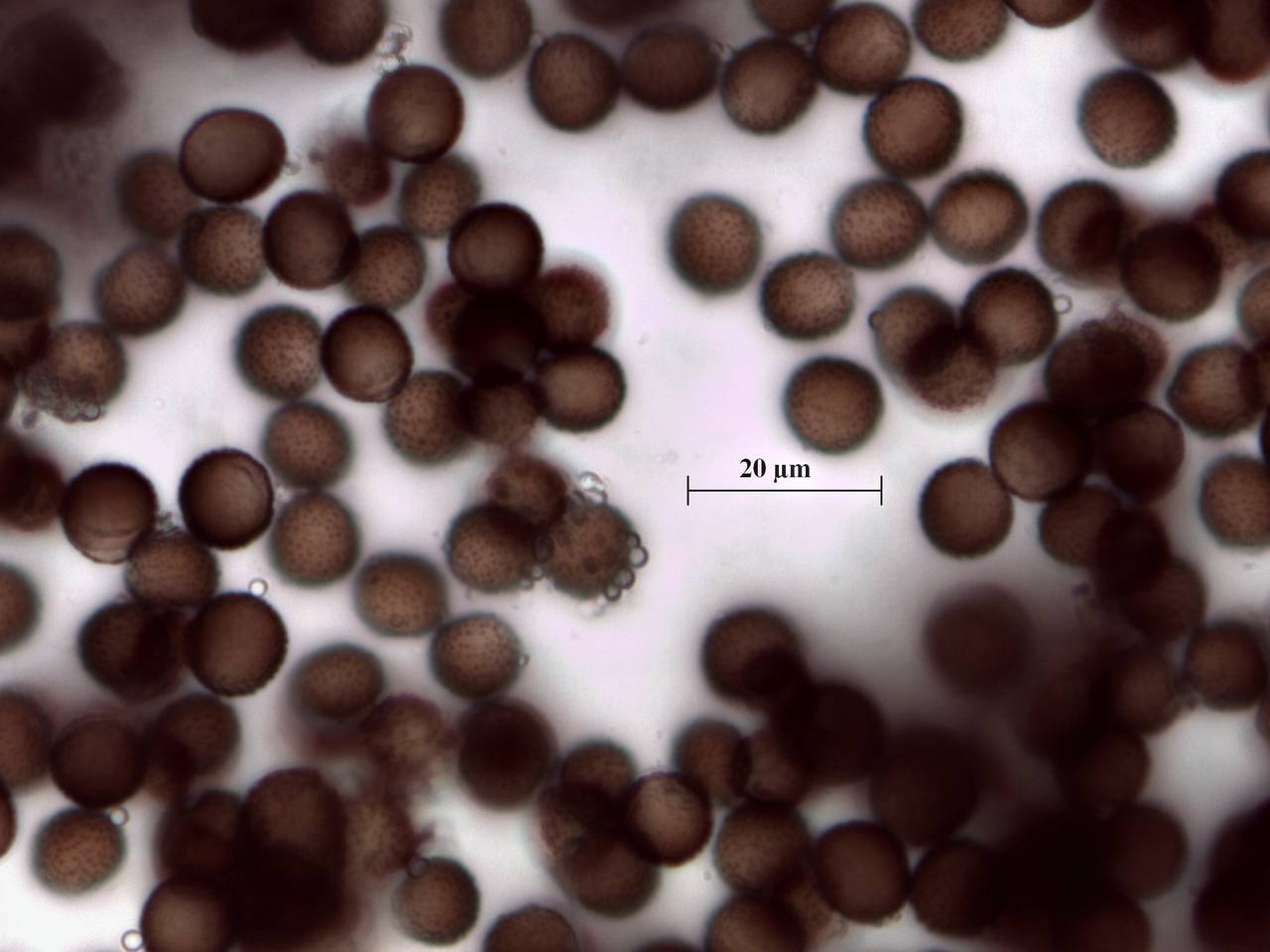 Physarum diderma - споры × 1000, Курагинский, Krasnoyarsk Krai (Russia)