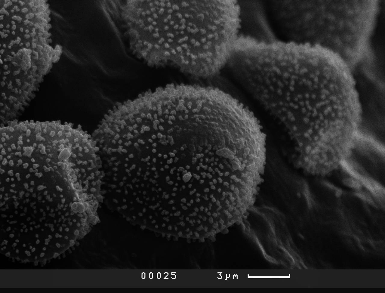 Lamproderma ovoideum - Споры, СЭМ, Тляратинский, Dagestan (Russia)