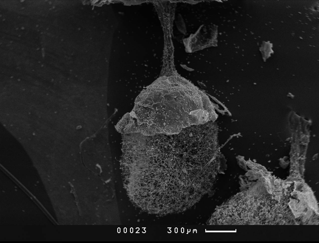 Lamproderma ovoideum - Споры, СЭМ, Тляратинский, Dagestan (Russia)