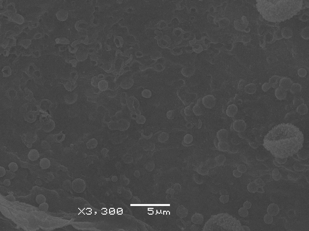 Lindbladia tubulina - Внутренняя поверхность перидия и споры, СЭМ, Селивановский, Vladimir Oblast (Russia)