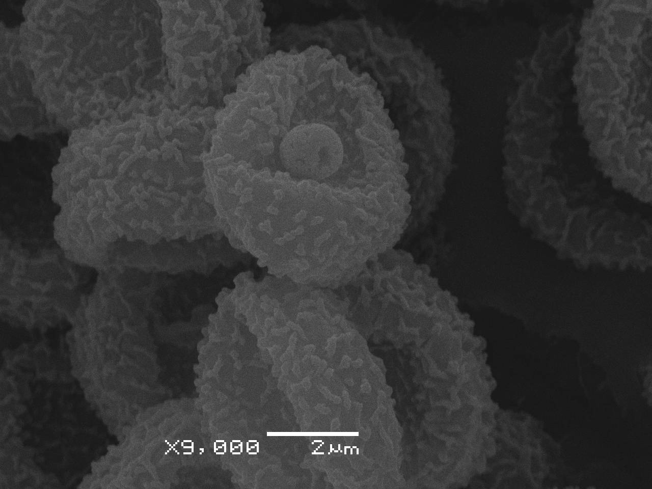 Lindbladia tubulina - Внутренняя поверхность перидия и споры, СЭМ, Селивановский, Vladimir Oblast (Russia)