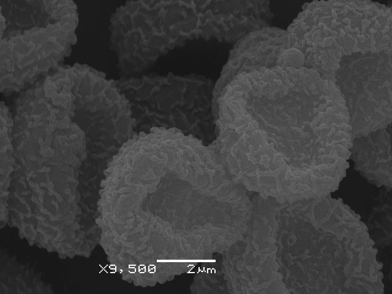 Lindbladia tubulina - Внутренняя поверхность перидия и споры, СЭМ, Селивановский, Vladimir Oblast (Russia)