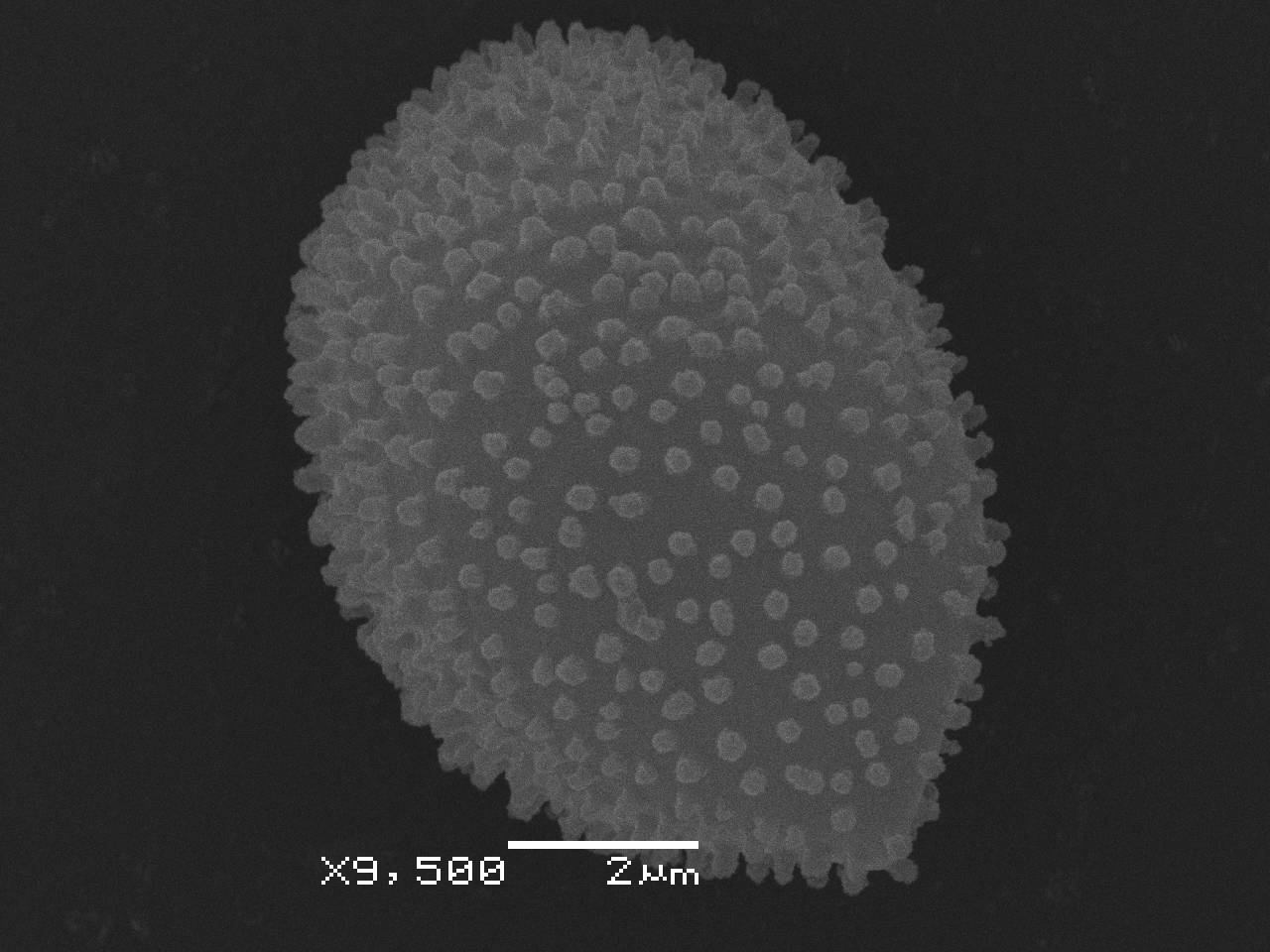 Physarum pezizoideum - Сеть капиллиция, СЭМ, Верхнедонской, Rostov Oblast (Russia)