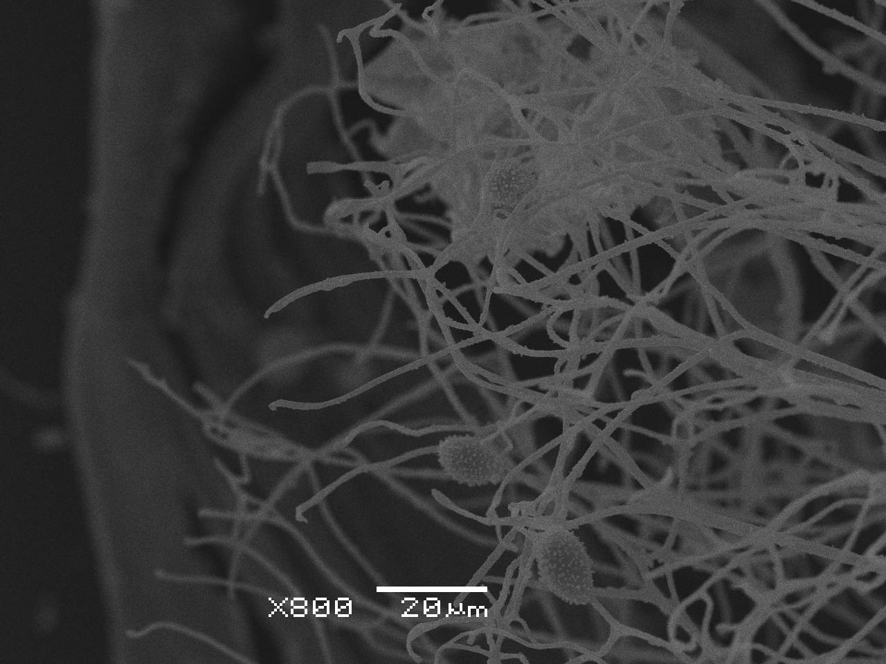 Lamproderma ovoideum - Споры, СЭМ, Нелидовский, Tver Oblast (Russia)