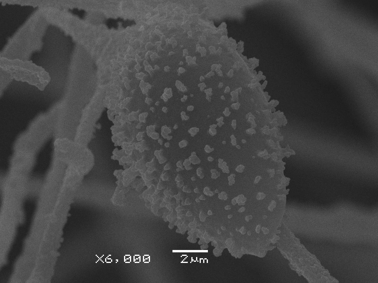 Lamproderma ovoideum - Споры, СЭМ, Нелидовский, Tver Oblast (Russia)