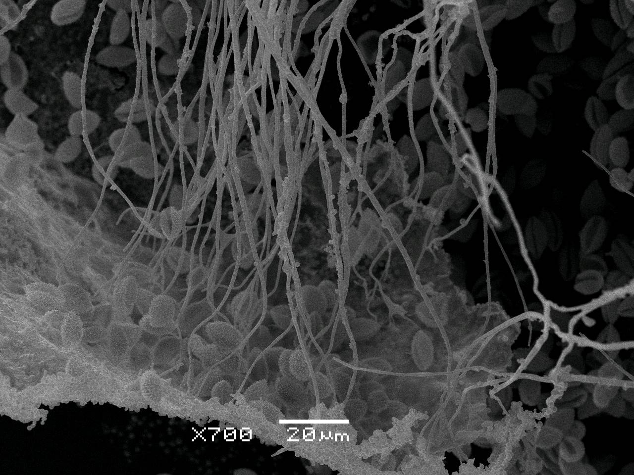 Diderma niveum - нити капиллиция отходящие от внутренней поверхности перидия, СЭМ, Нелидовский, Tver Oblast (Russia)