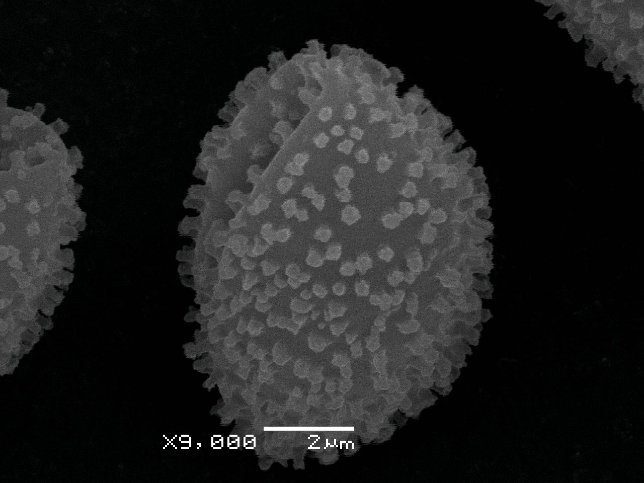 Diderma niveum - нити капиллиция отходящие от внутренней поверхности перидия, СЭМ, Нелидовский, Tver Oblast (Russia)
