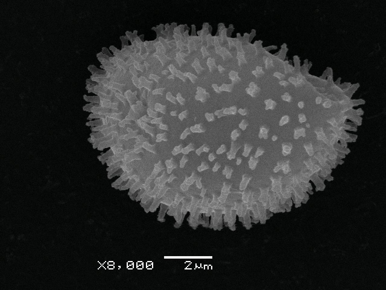 Lepidoderma chailetii - споры на поверхности нитей капиллиция, СЭМ, Нелидовский, Tver Oblast (Russia)
