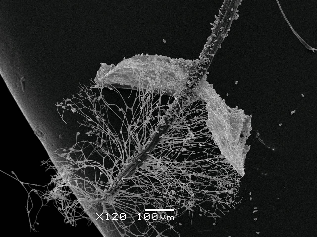 Lamproderma album  - внешний вид спорангия, СЭМ, Нелидовский, Tver Oblast (Russia)