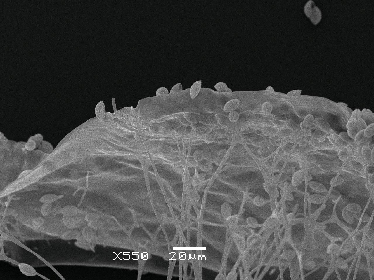 Lamproderma album  - внешний вид спорангия, СЭМ, Нелидовский, Tver Oblast (Russia)