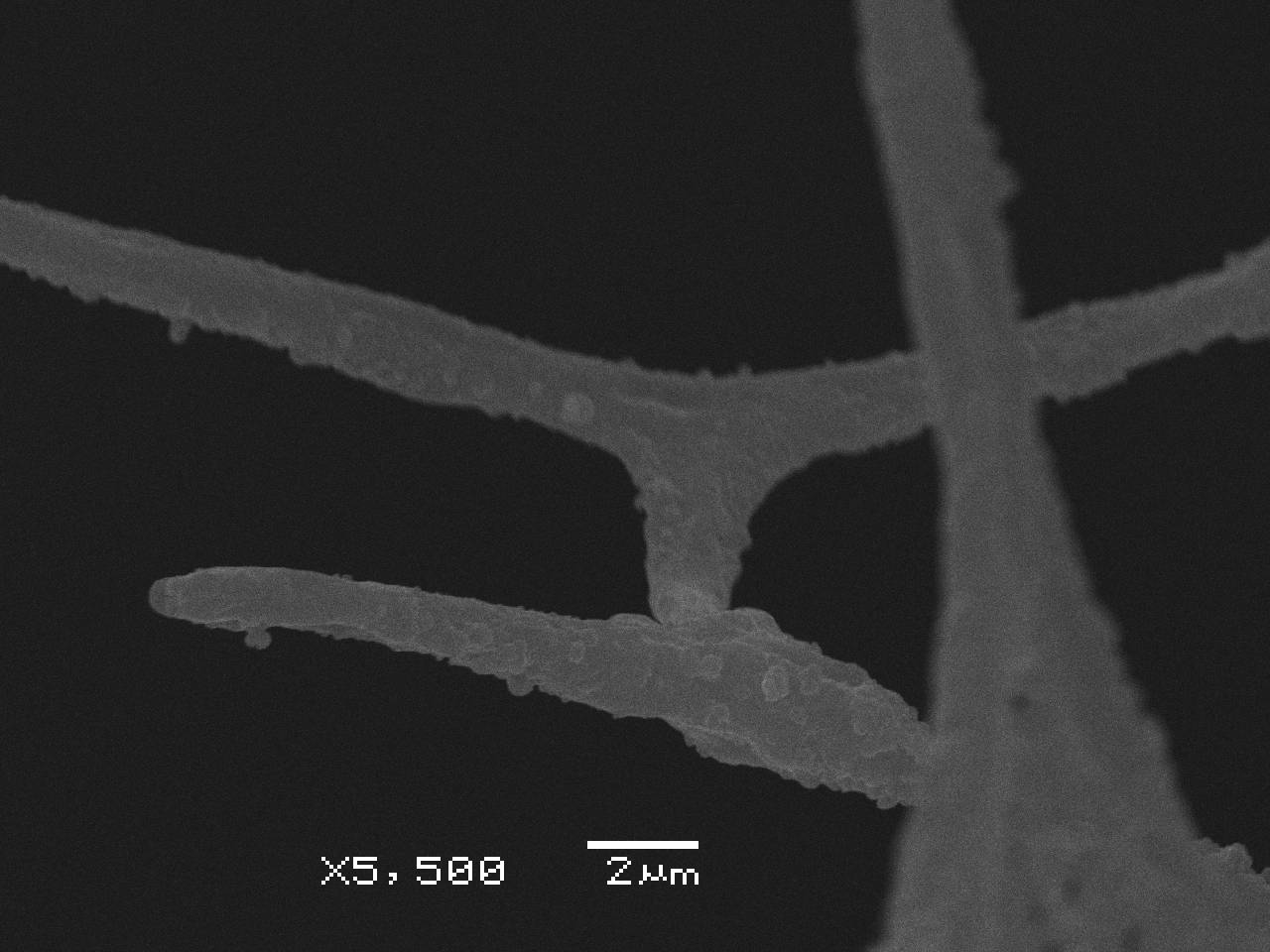 Lamproderma album  - внешний вид спорангия, СЭМ, Нелидовский, Tver Oblast (Russia)