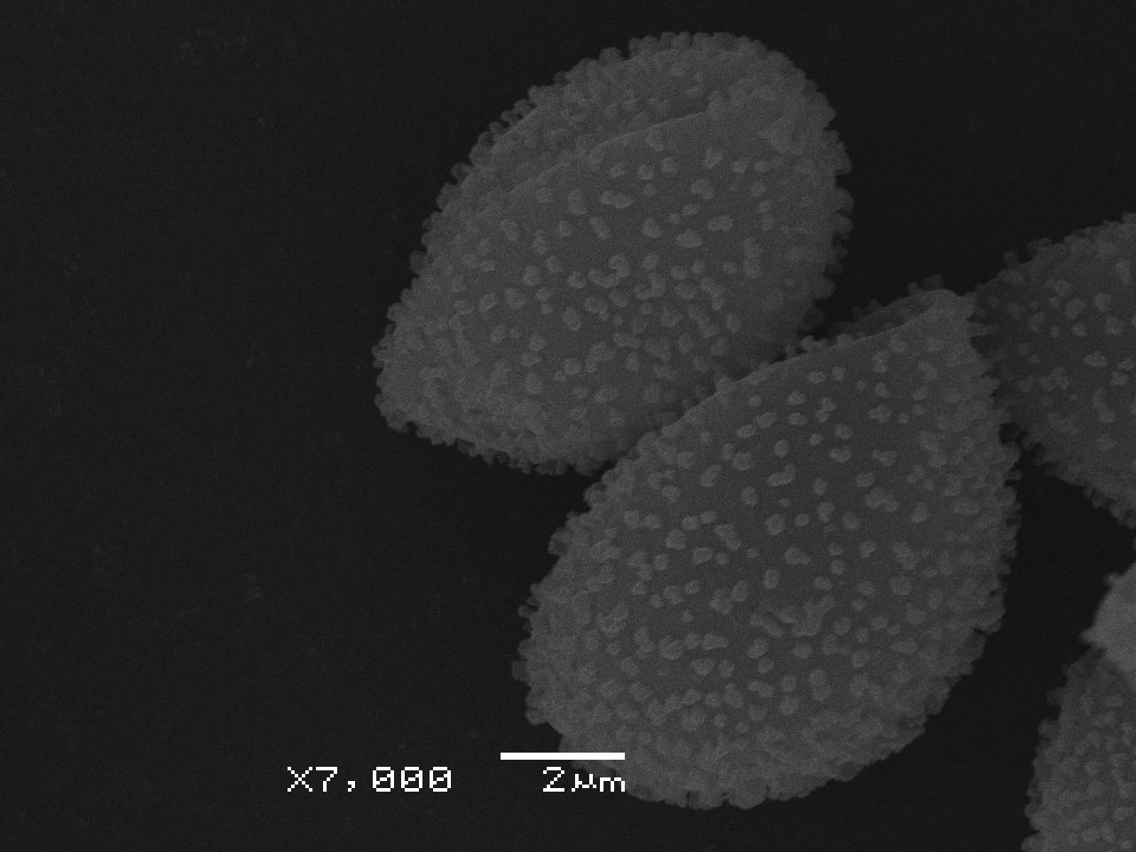 Lamproderma album  - внешний вид спорангия, СЭМ, Нелидовский, Tver Oblast (Russia)