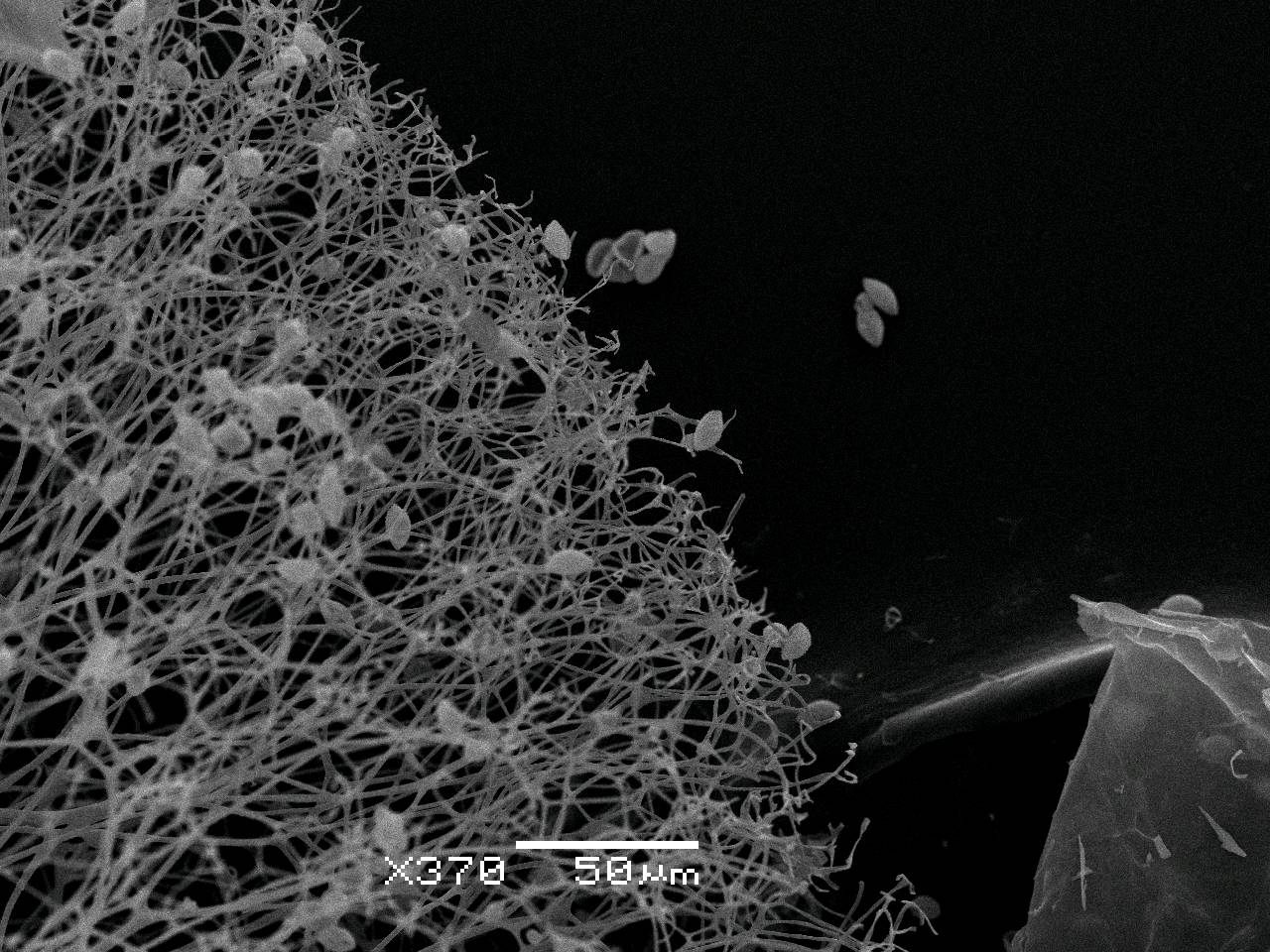 Lamproderma ovoideum - поверхностная сеть капиллиция, СЭМ, Нелидовский, Tver Oblast (Russia)