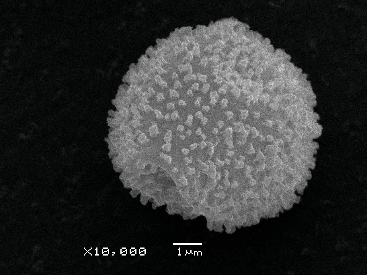 Lamproderma ovoideum - поверхностная сеть капиллиция, СЭМ, Нелидовский, Tver Oblast (Russia)