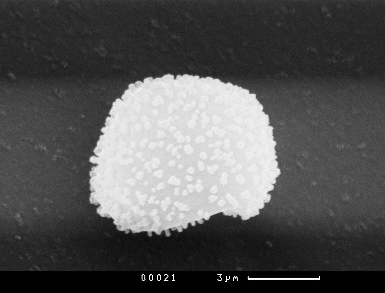 Lamproderma ovoideum - спора, СЭМ, Нелидовский, Tver Oblast (Russia)