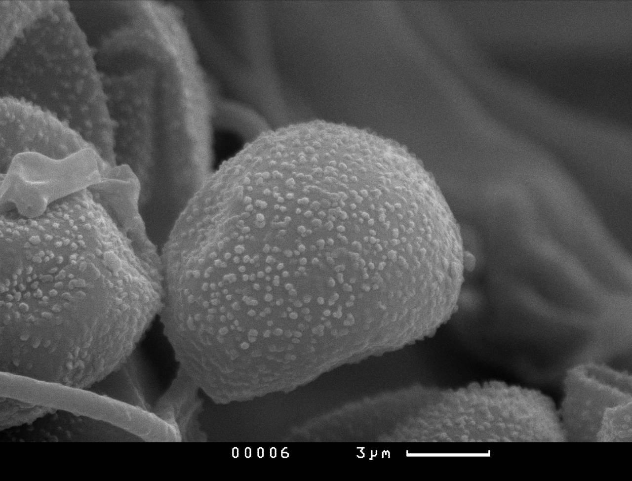 Lamproderma ovoideum - спора, СЭМ, Нелидовский, Tver Oblast (Russia)