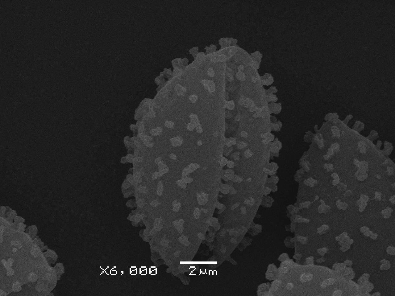 Lamproderma zonatum - спора, СЭМ, Нелидовский, Tver Oblast (Russia)