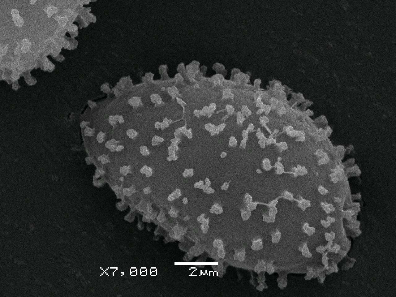 Lamproderma zonatum - спора, СЭМ, Нелидовский, Tver Oblast (Russia)