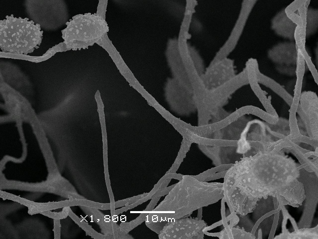 Lamproderma zonatum - спора, СЭМ, Нелидовский, Tver Oblast (Russia)