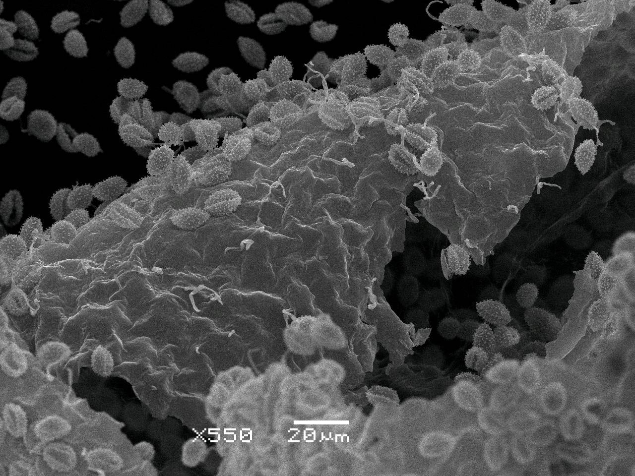 Lamproderma zonatum - спора, СЭМ, Нелидовский, Tver Oblast (Russia)