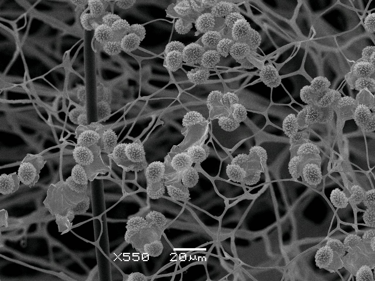 Meriderma carestiae - споры на поверхности капиллиция, СЭМ, Нелидовский, Tver Oblast (Russia)