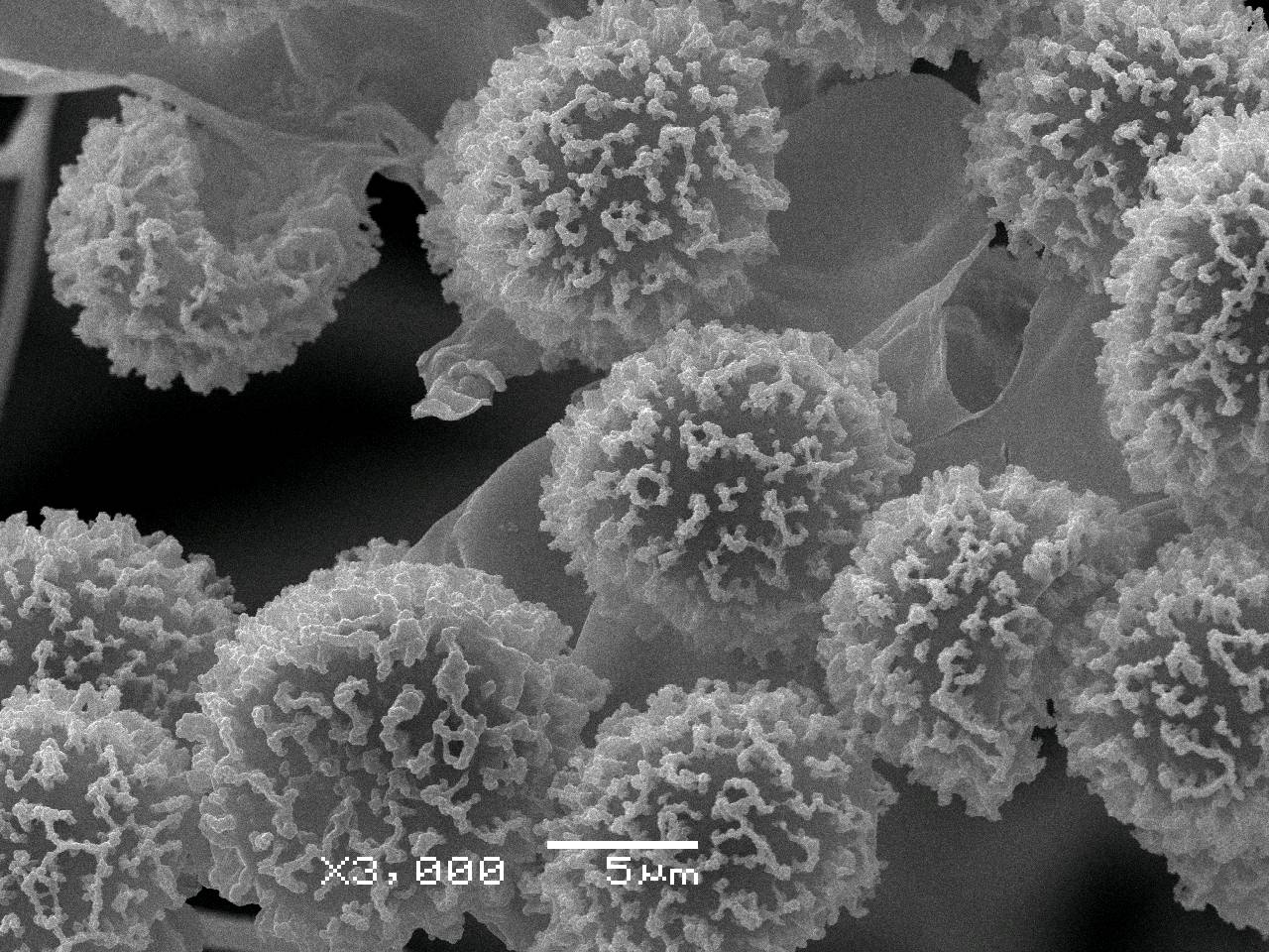 Meriderma carestiae - споры на поверхности капиллиция, СЭМ, Нелидовский, Tver Oblast (Russia)