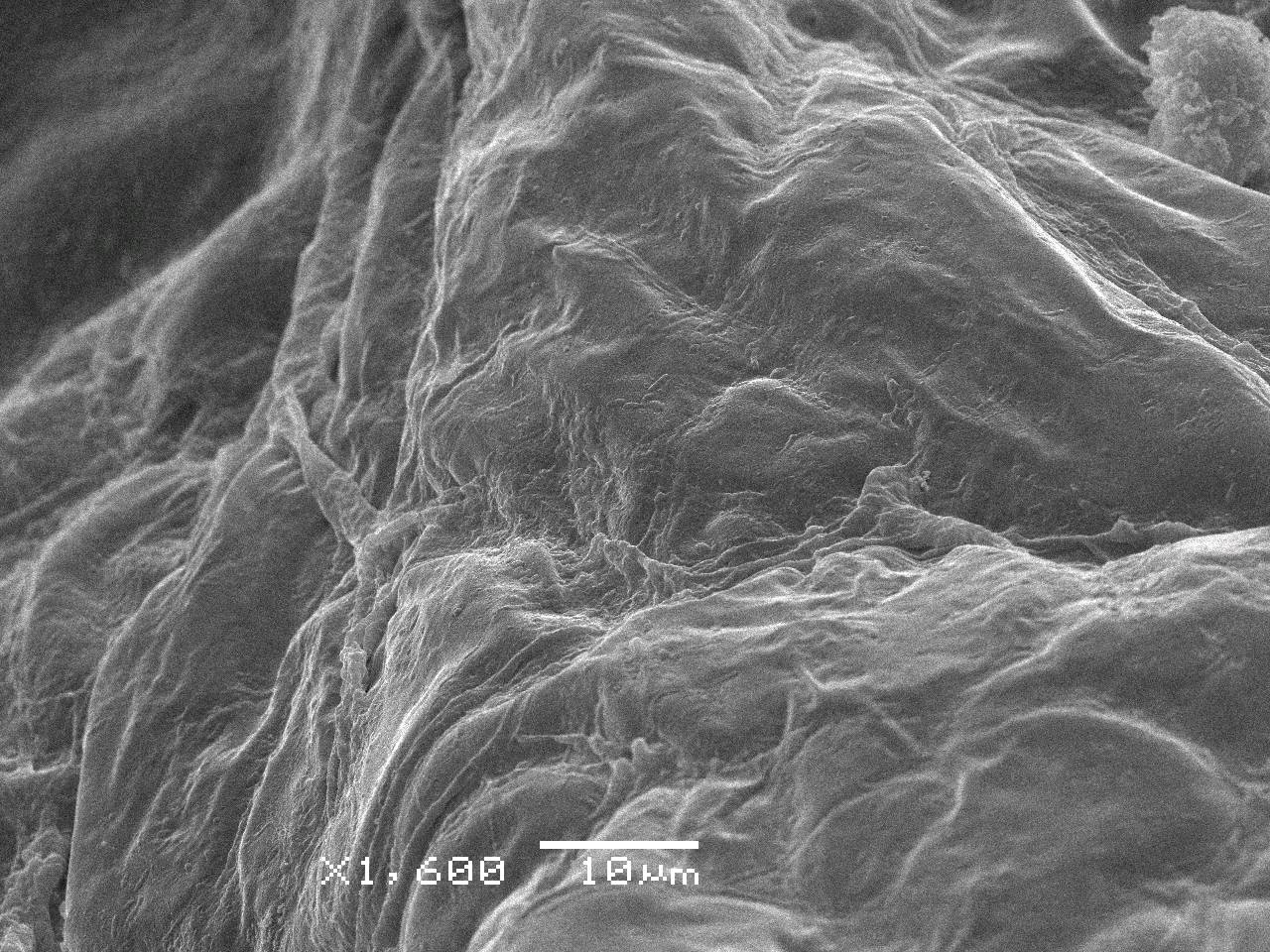 Meriderma carestiae - споры на поверхности капиллиция, СЭМ, Нелидовский, Tver Oblast (Russia)