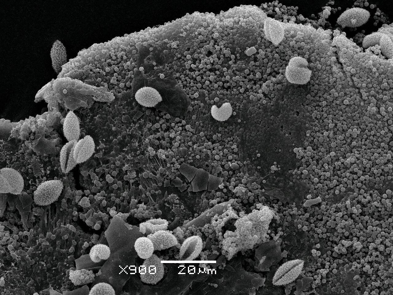 Diderma niveum - поверхность перидия, СЭМ, Нелидовский, Tver Oblast (Russia)