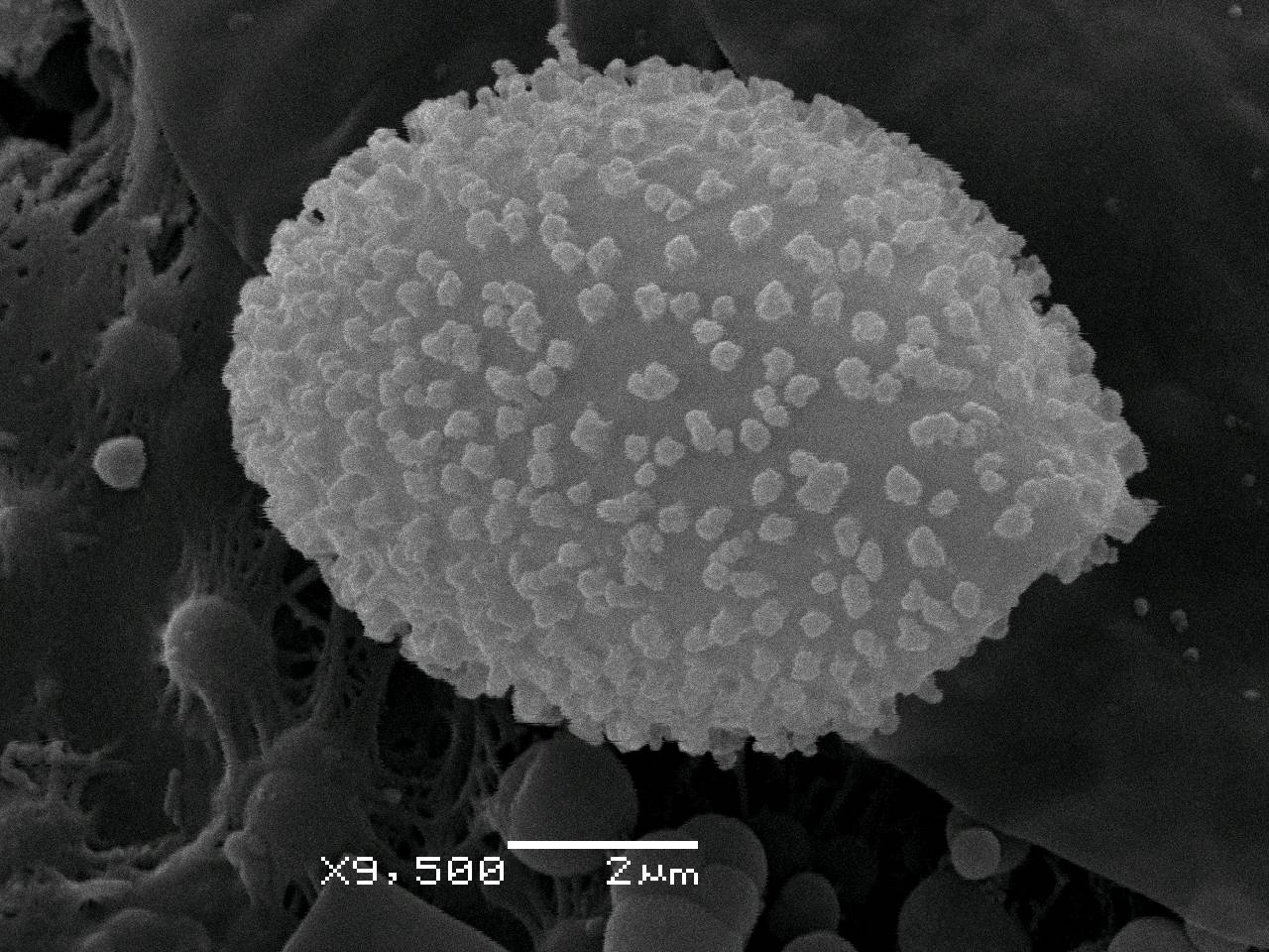 Diderma niveum - поверхность перидия, СЭМ, Нелидовский, Tver Oblast (Russia)