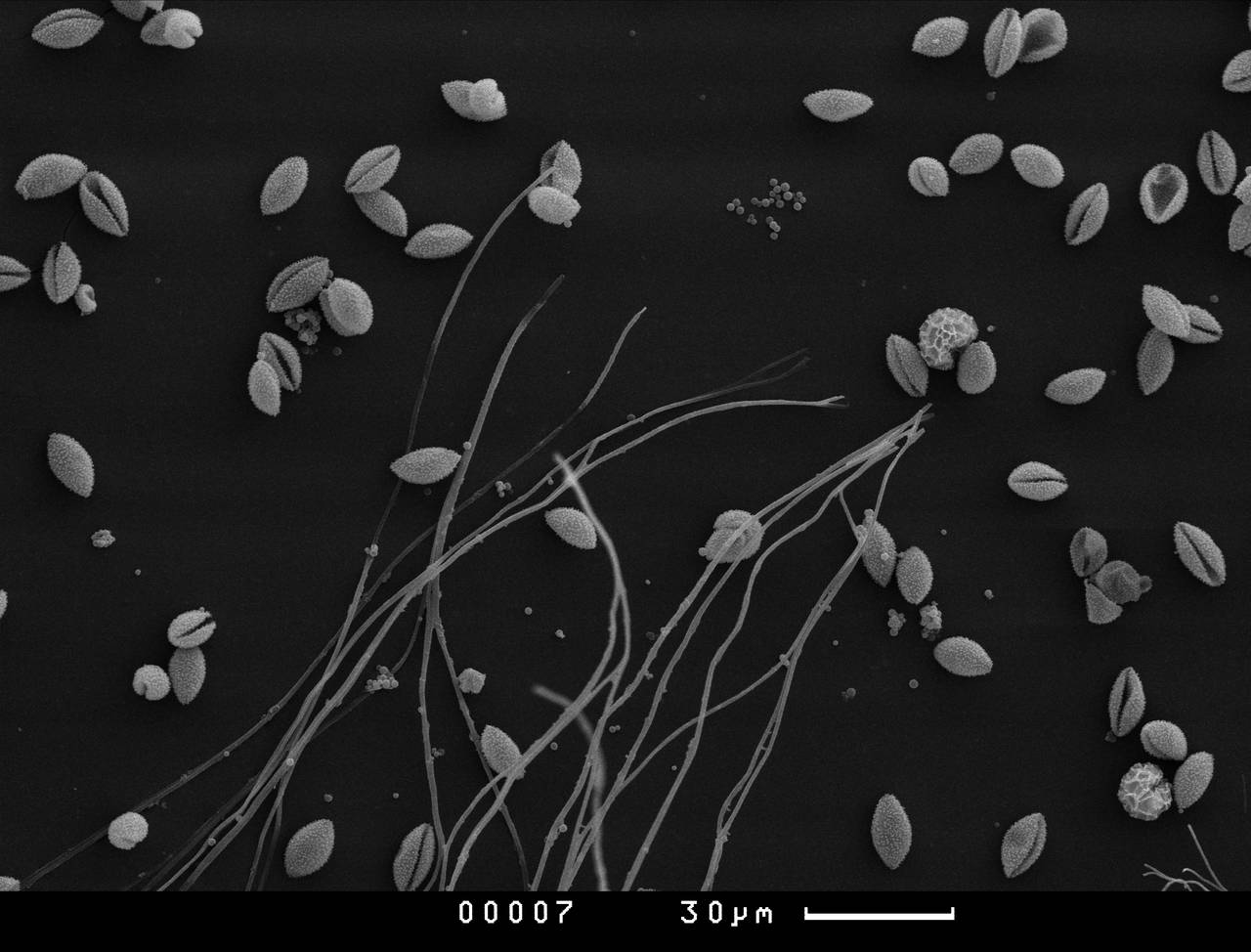 Diderma niveum - поверхность перидия, СЭМ, Нелидовский, Tver Oblast (Russia)