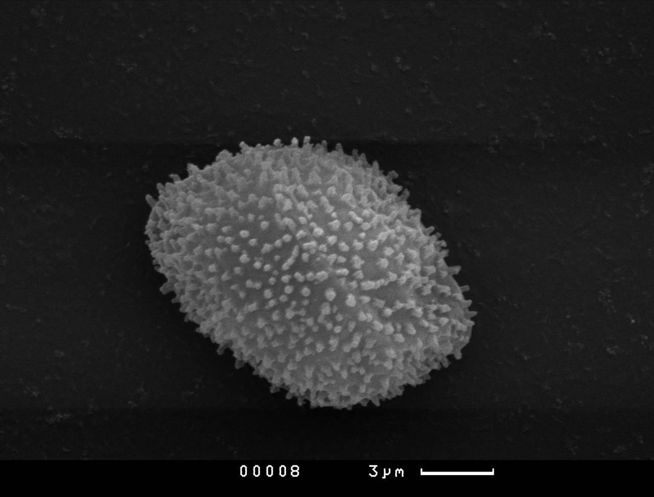 Diderma niveum - поверхность перидия, СЭМ, Нелидовский, Tver Oblast (Russia)