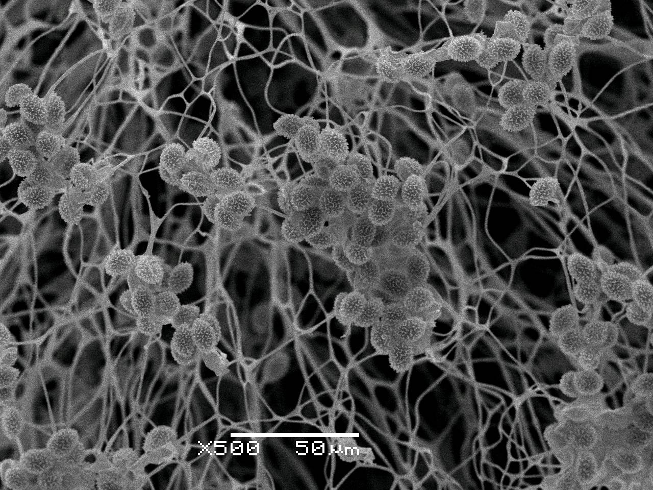 Meriderma carestiae - споры и капиллиций, СЭМ, Нелидовский, Tver Oblast (Russia)