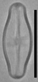 Масштаб - 10 мкм., Рузский район, Moscow Oblast (Russia)