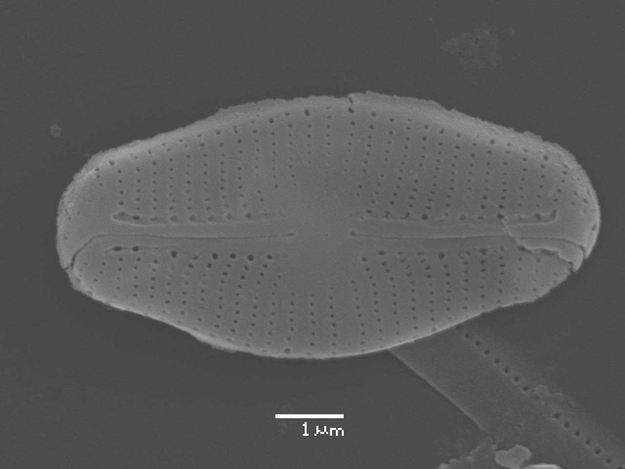 Масштаб - 10 мкм., Рузский район, Moscow Oblast (Russia)