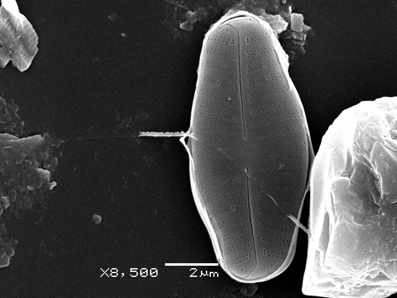 Масштаб - 10 мкм., Рузский район, Moscow Oblast (Russia)