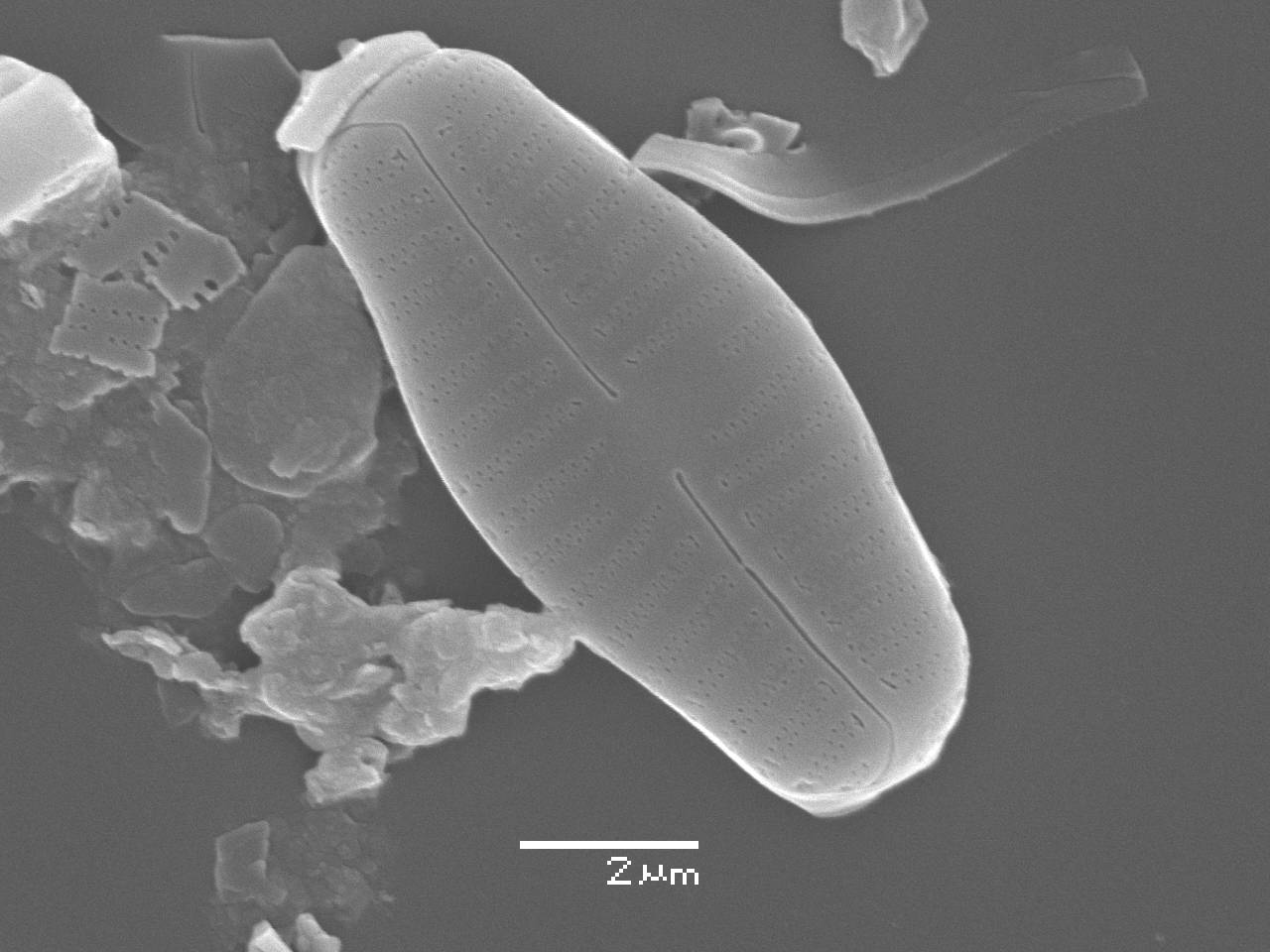 Масштаб - 10 мкм., Рузский район, Moscow Oblast (Russia)