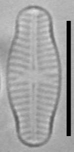 Масштаб - 10 мкм., Рузский район, Moscow Oblast (Russia)